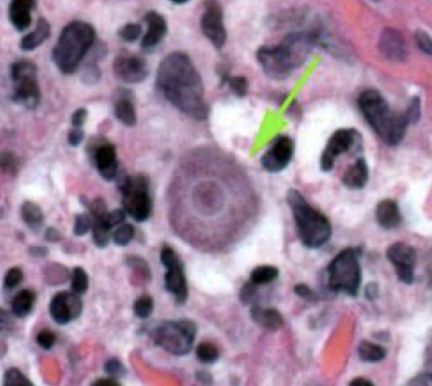 <p>What parasite is this?</p>