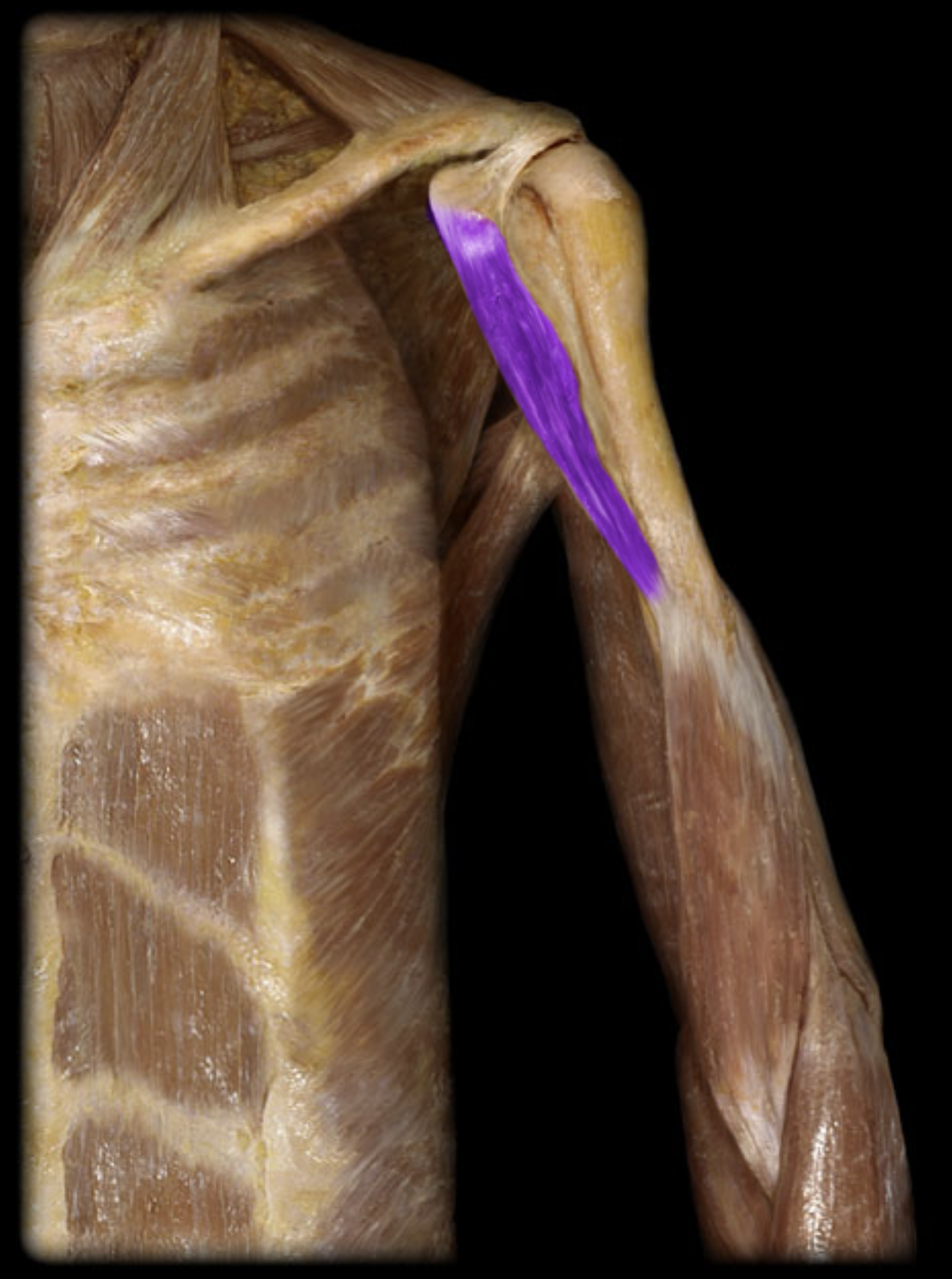 <p>What is the origin of this muscle?</p>