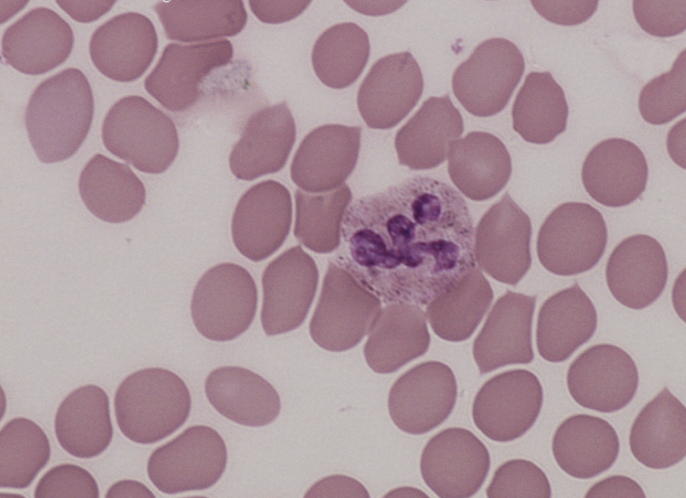 <p><span style="background-color: rgba(0, 0, 0, 0); line-height: 19.55px;">Purple multi-lobed nucleus,</span></p>
