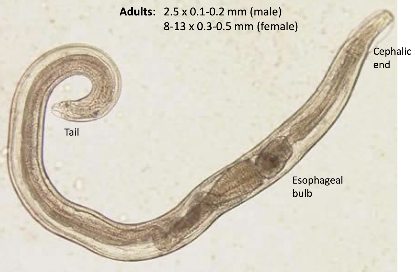 <p>what helminth is this?</p>
