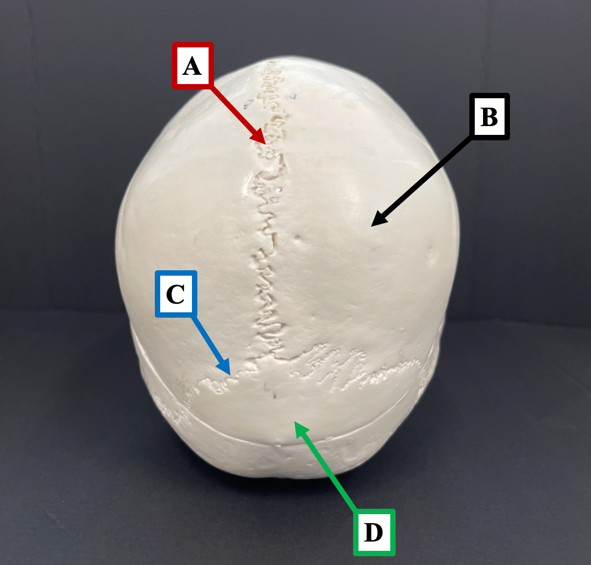 <p>Identify the name of the suture that label <strong>C</strong> is pointing to.</p>