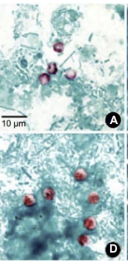 <p>-Oocysts 4-6 um (slightly smaller than RBC)</p>