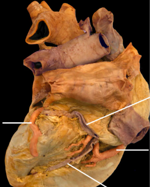 <p>Name the structures</p>