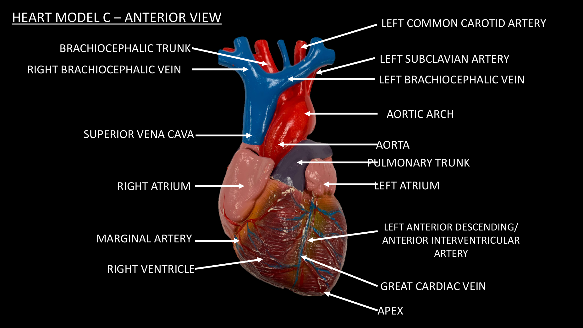 <p>LEFT ATRIUM</p>