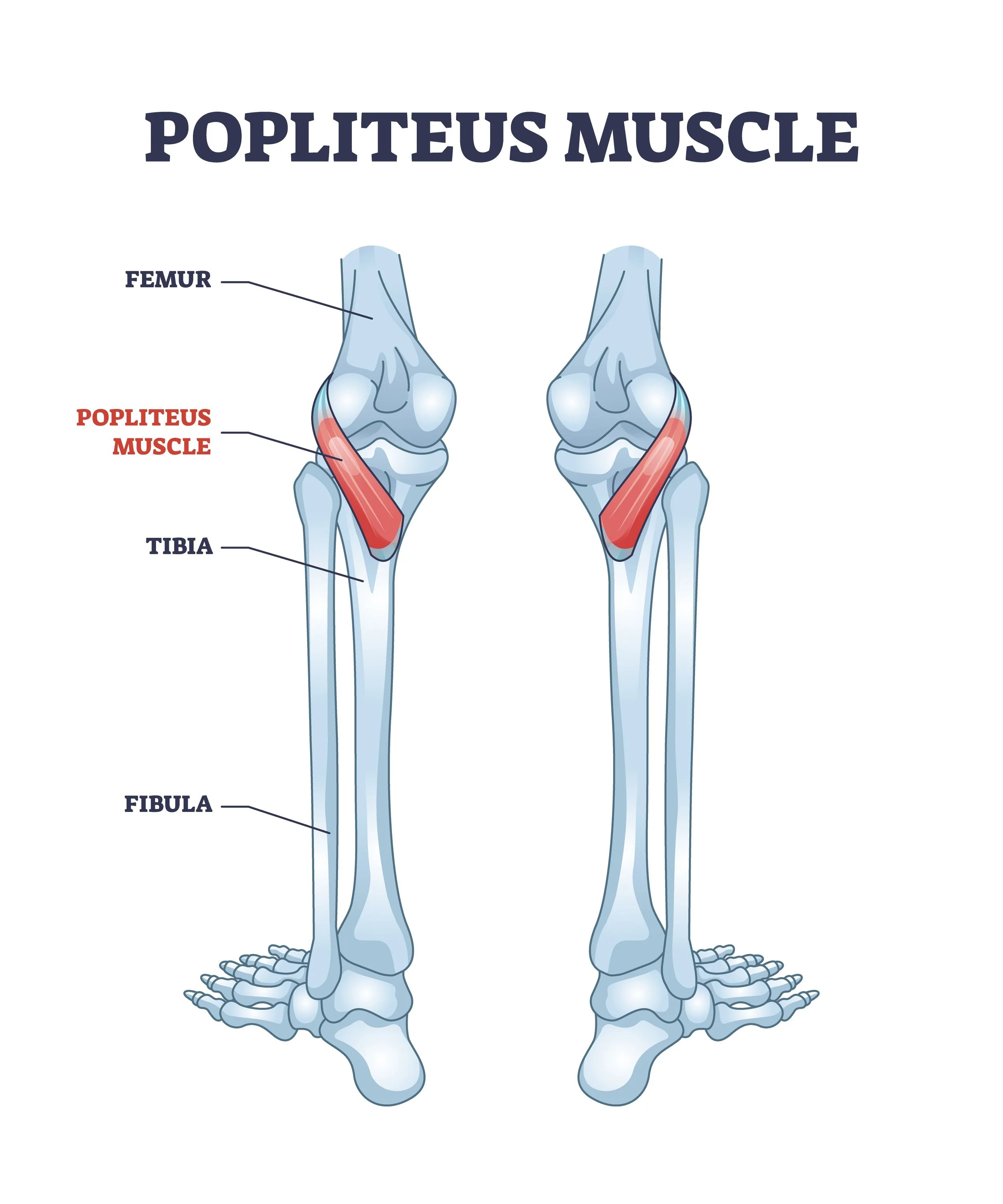 <p>Proximal Attachment (O): Lateral surface of lateral condyle of femur and lateral meniscus</p><p>Distal Attachment (I): Posterior surface of tibia and superior to soleal line</p><p>Nerve: Tibial nerve (L4, L5, S1)</p><p>Action: Weakly flexes knee joint and unlocks it by rotating femur 5° on fixed tibia; medially rotates tibia of unplanted limb</p>