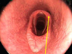 <p>Is this normal or abnormal? What is happening?</p>