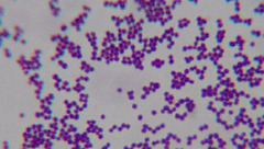 <p>Staphyle: Greek for "bundle of grapes" </p><p>Normal flora of the skin, mucous, feces </p><p>Facultative anaerobe </p><p>Tolerates high salt environments (skin) </p><p>Non-motile </p><p>Catalase (+)</p><p>Gram-Positive cocci in clusters</p>