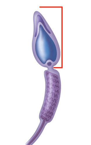 <p>made up of the acrosome and nucleus</p>