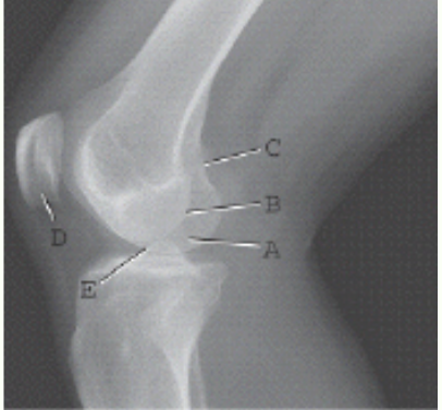 <p><span>This radiograph represents which of the following positions?</span></p>
