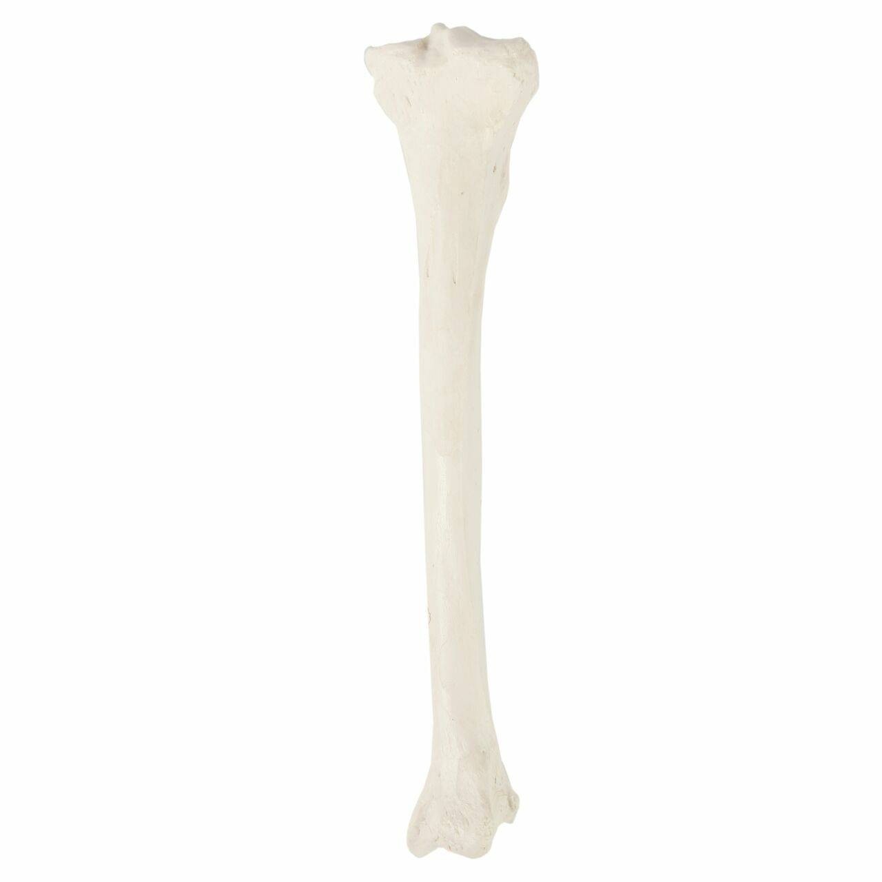 <p>What bone is this?</p>