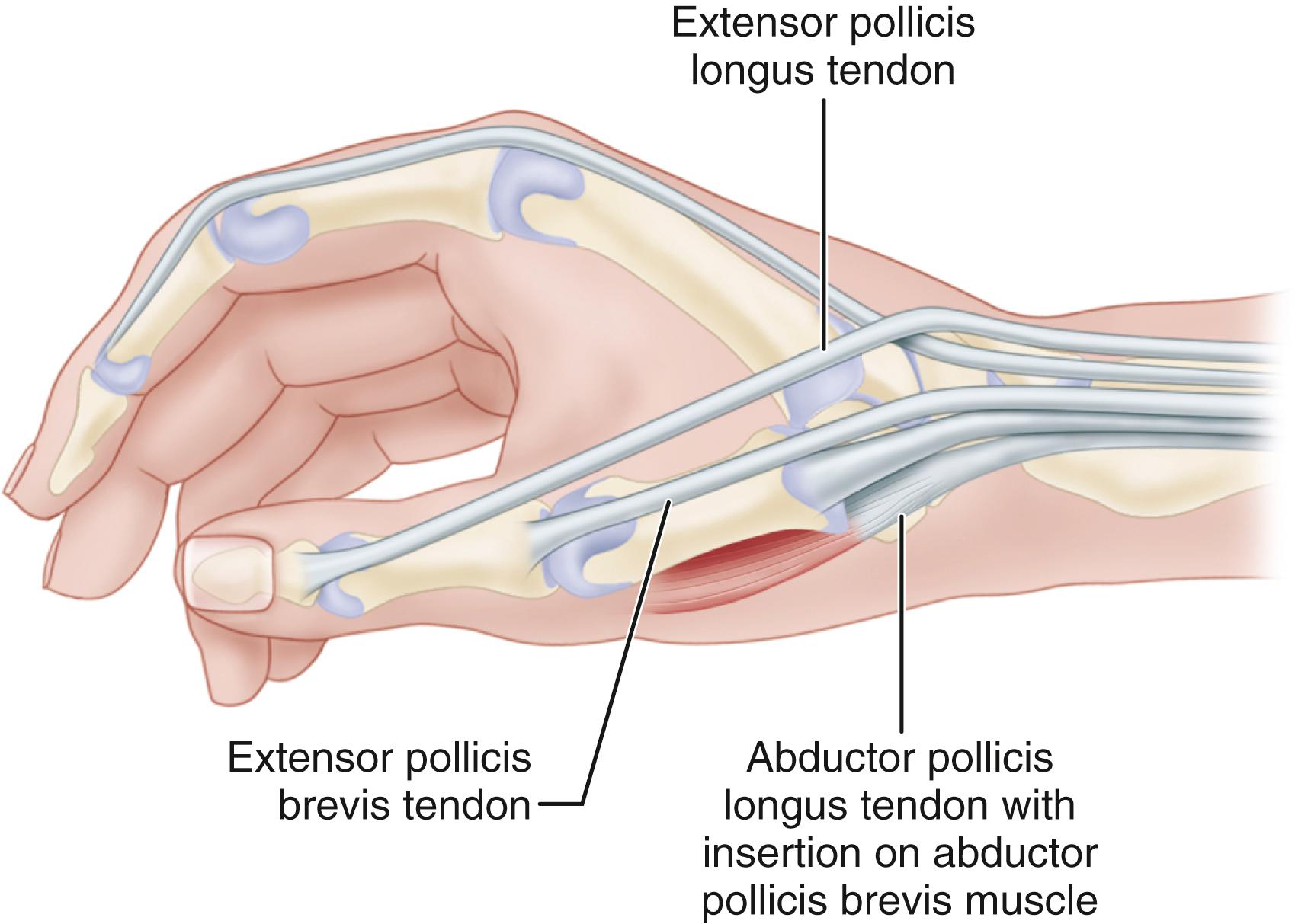 <p class="Paragraph SCXW44369541 BCX0" style="text-align: left;"><span style="line-height: 22.0875px;">The Brevis extends thumb's&nbsp;MCP joint, and Longus extends thumb's IP joint&nbsp;</span></p>