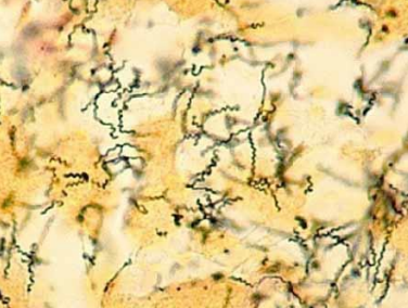 <p>PATHOGENIC BACTERIA:</p>