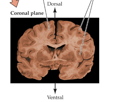 <p>divides between front and back</p>