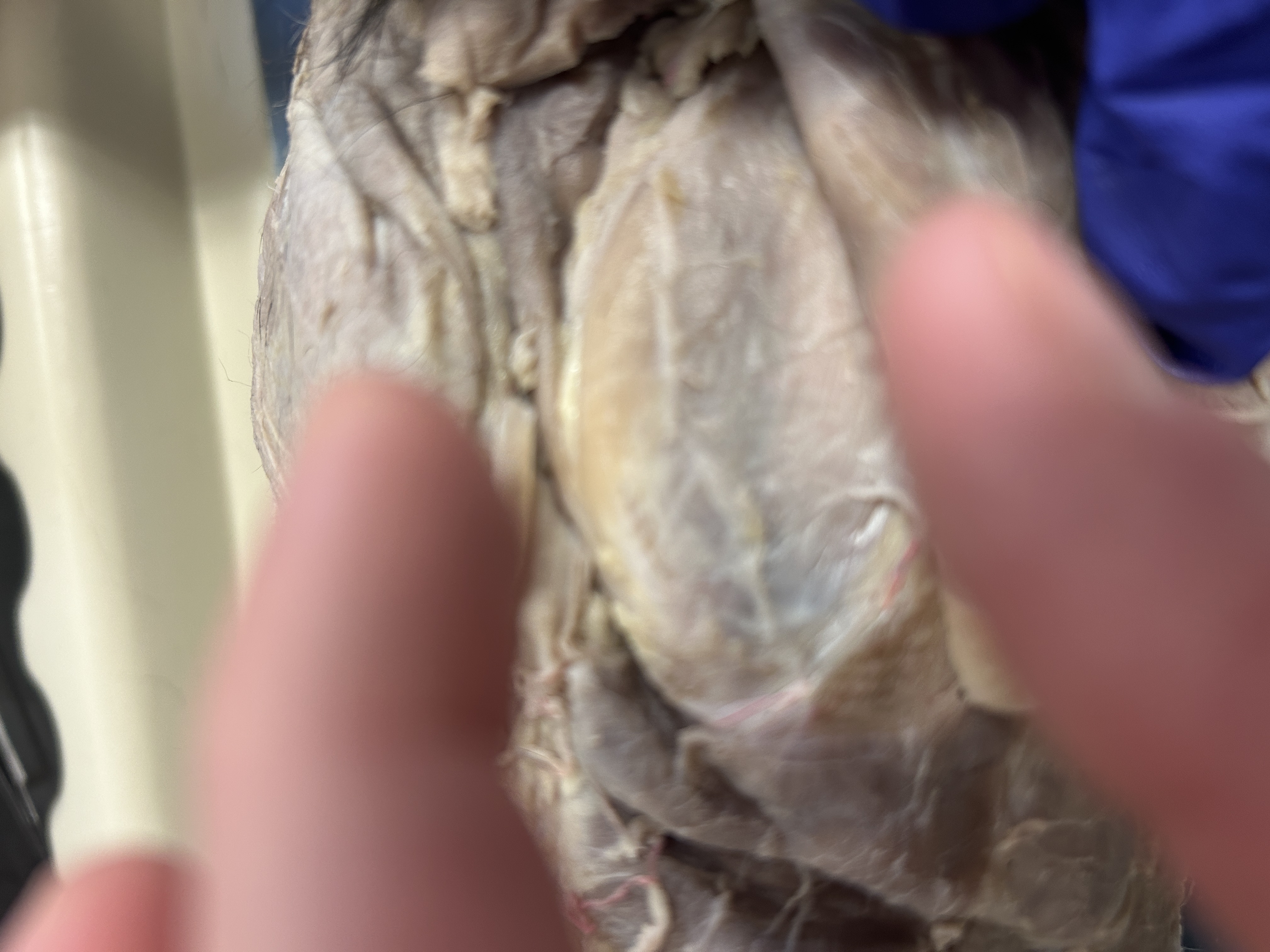 <p>Supraspinatus (part under flap near shoulder on back)</p>