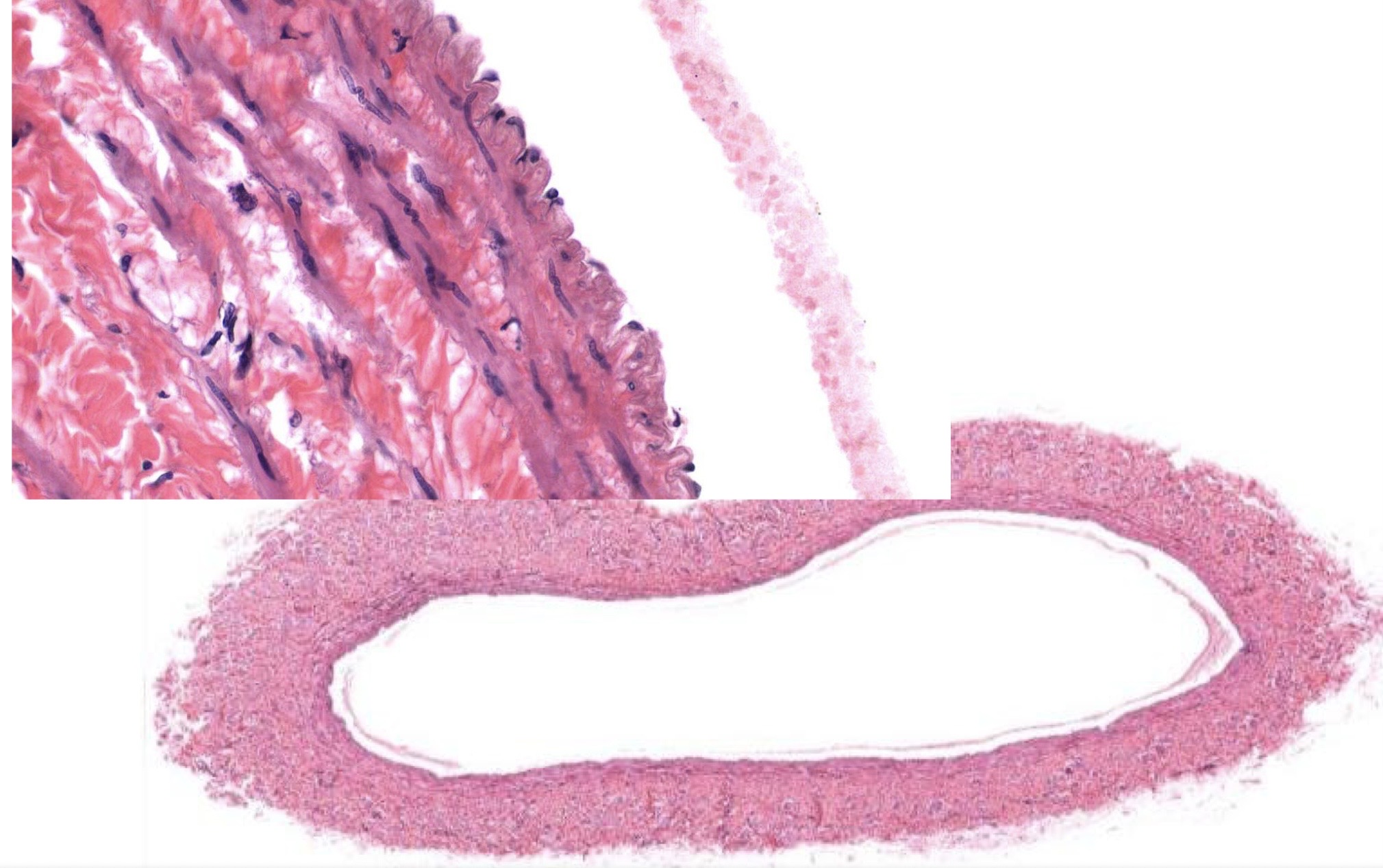 <p>Identify the Vessel and the Layer pictured</p>