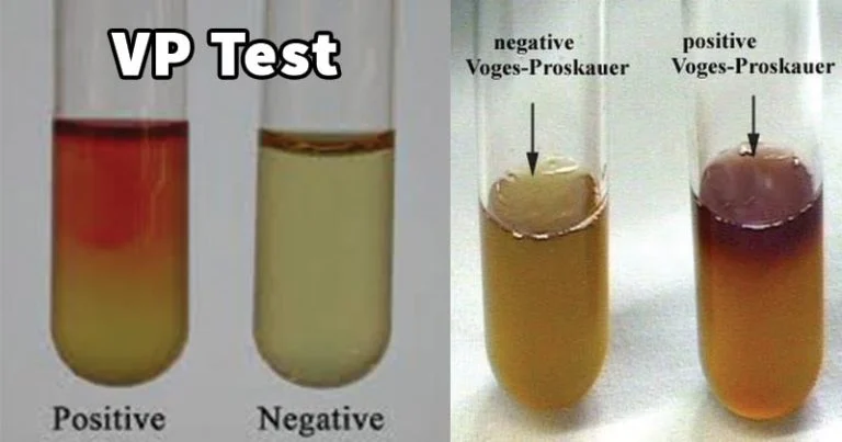 <p>VP</p>