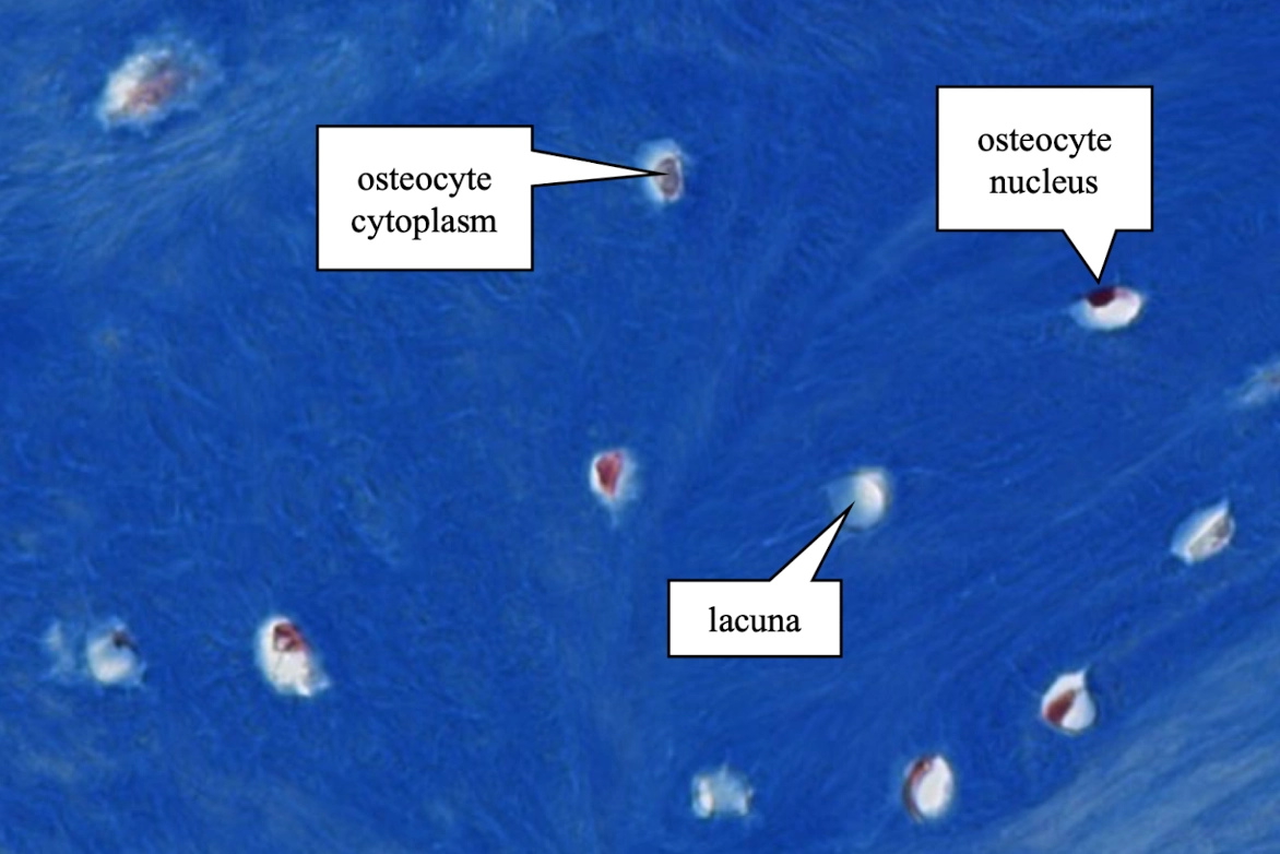 <p>Identify a small cell located within a lacuna. In appropriate sections, its cytoplasmic processes extend into tiny canaliculi radiating through the surrounding matrix.</p>