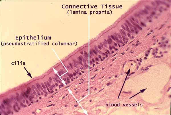 <p><strong>pseudostratified (ciliated) columnar </strong>epithelium</p>