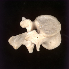 <p>Name of vertebrae and bones</p>