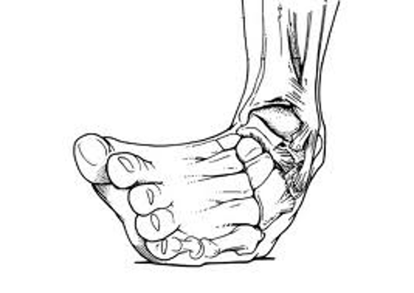 <p>to sprain</p>