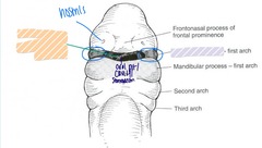 <p>Maxillary process (first arch)</p>