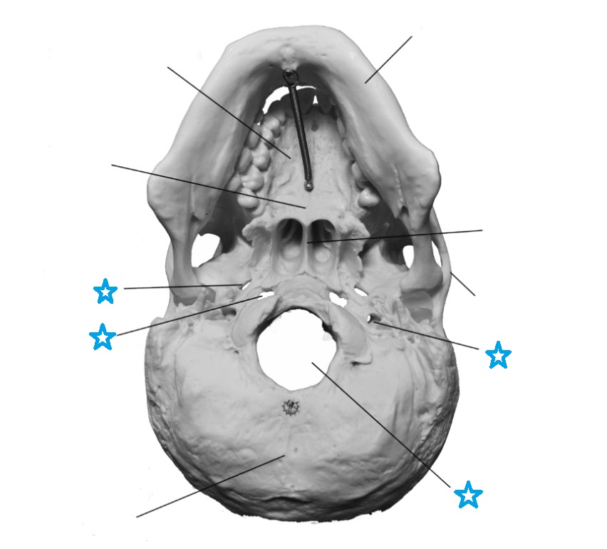 <p>Identify this bone feature labeled by the blue stars and define its anatomical purpose.</p>