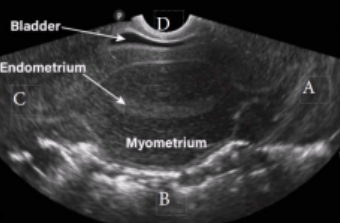 <p><span style="background-color: transparent;">What is letter D in this image?</span></p><p><span style="background-color: transparent;">a. Anterior&nbsp;</span></p><p><span style="background-color: transparent;">b. Superior&nbsp;</span></p><p><span style="background-color: transparent;">c. Posterior&nbsp;</span></p><p><span style="background-color: transparent;">d. Inferior</span></p>