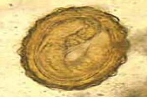 <p><span style="background-color: rgba(0, 0, 0, 0); line-height: 19.7625px;">What is the species in this photo? Is this stage the infective stage?</span></p>