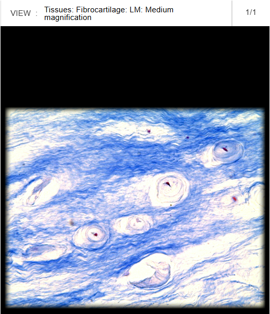 <p>Lateral meniscus</p>