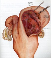 <p>When are placentomes first palpable?</p>