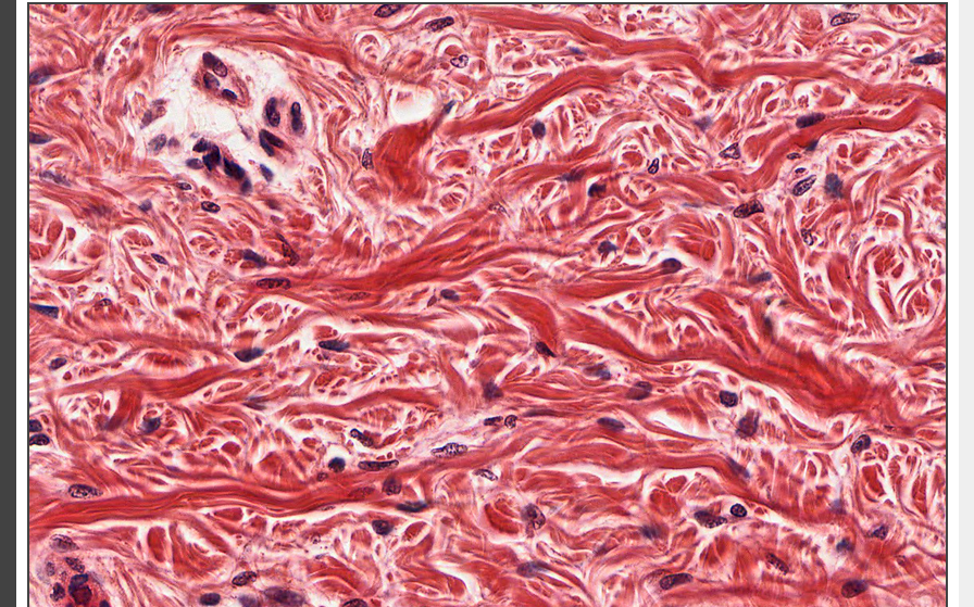 <p>what tissue is this </p>