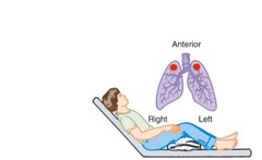 <p>Anterior Upper Segment </p><p>-Position the patient sitting and leaning back at about a 45 degree angle.</p><p>- Area to percuss is just below the clavicle.</p>