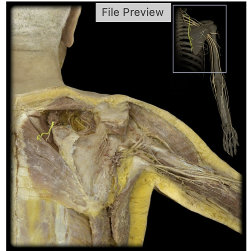 <p>What’s the spinal level of the dorsal scapular nerve?</p>