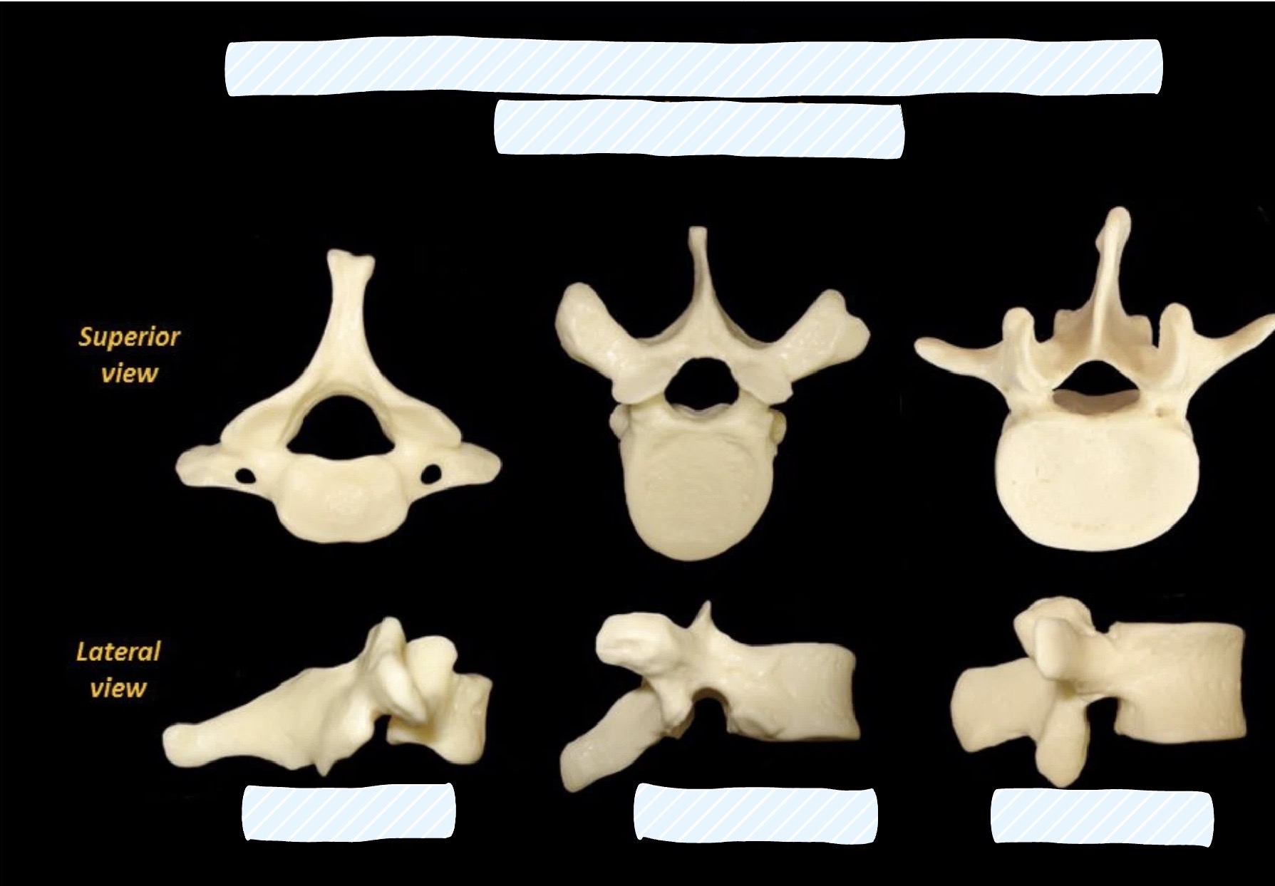 <p><span style="background-color: transparent;">Recognize cervical vs thoracic vs lumbar vertebrae (include numbers)</span></p>
