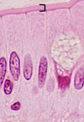 <p>What is the structure pictured?</p>