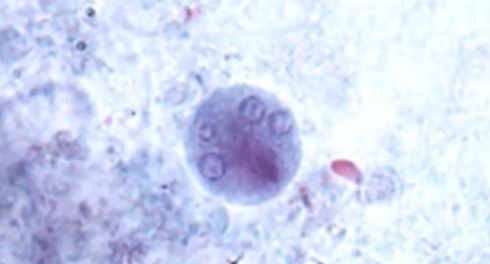 <p><span style="background-color: rgba(0, 0, 0, 0); line-height: 19.7625px;">What is the species in this photo and WHY </span><span style="line-height: 19.7625px;">(size 20&nbsp;</span><span style="line-height: 19.7625px; color: windowtext;">μm)</span><span style="background-color: rgba(0, 0, 0, 0); line-height: 19.7625px;">?</span></p>