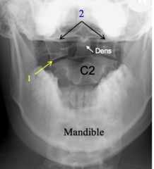 <p>Identify the structure at #1</p>