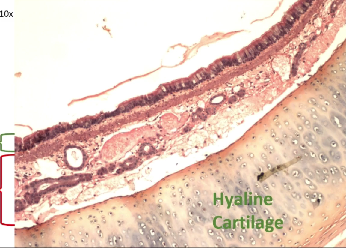 <p>Tissue red section?</p>