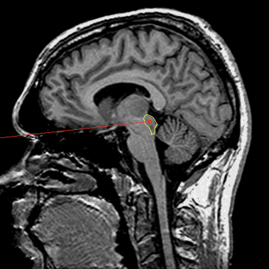<p>What is the area highlighted called?</p>