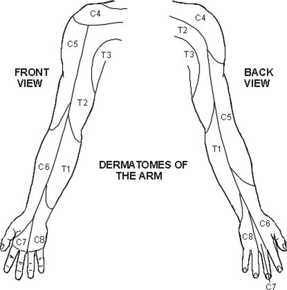 <p>C5-T1</p>