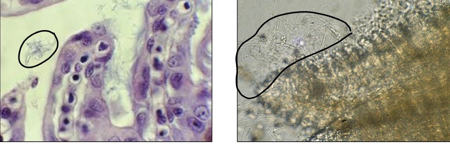 <p>What bacteria is shown on the following slides?</p>