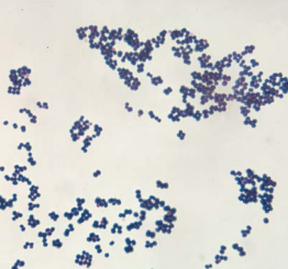 <p>what shape of bacteria is this </p>