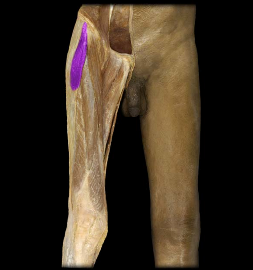 <p>What muscle is this?</p>