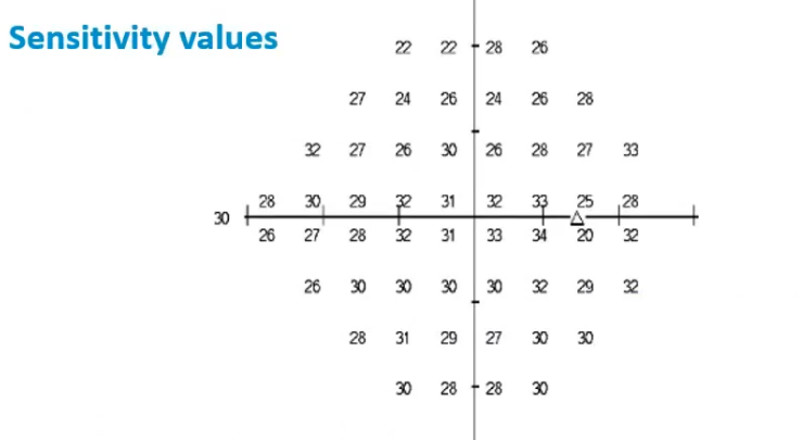 <p>sensitvity values : interpreting VF plot </p>