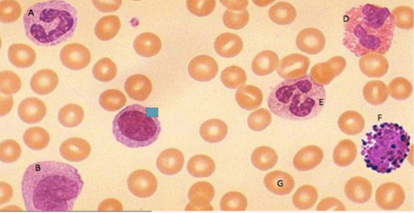 <p>Identify the following blood-formed element</p>