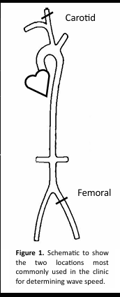 <p>Sphygmocor</p>