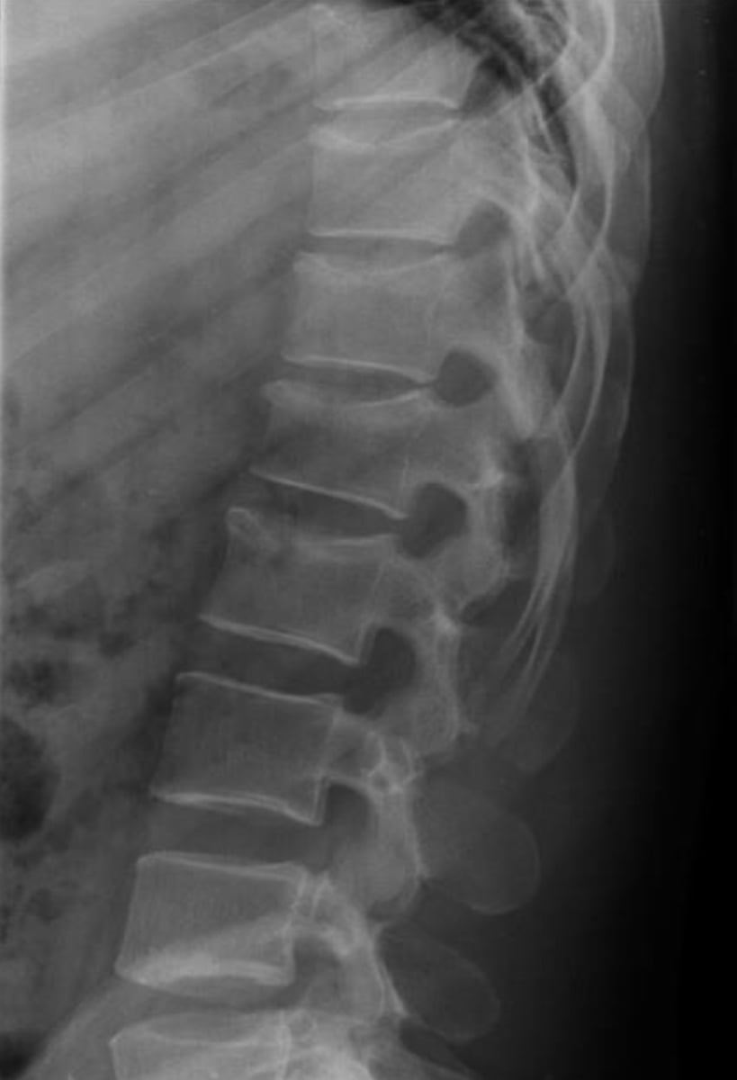 <p>What is the findings &amp; Diagnosis?</p>