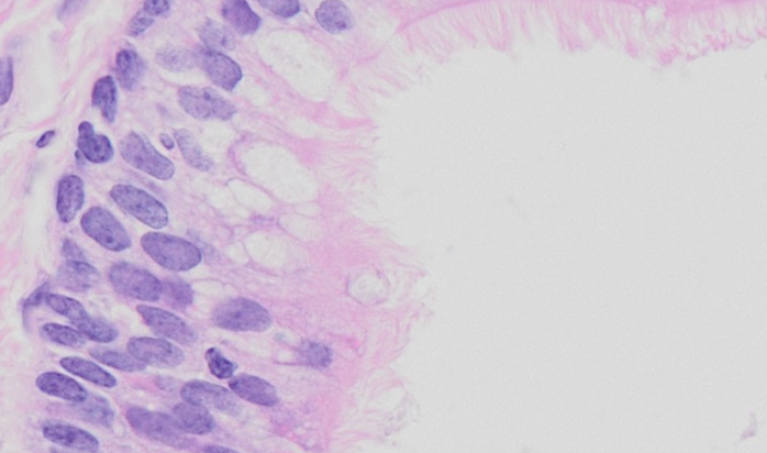 <p>Their mucin content is poorly stained by H&amp;E but stains strongly with PAS.</p>