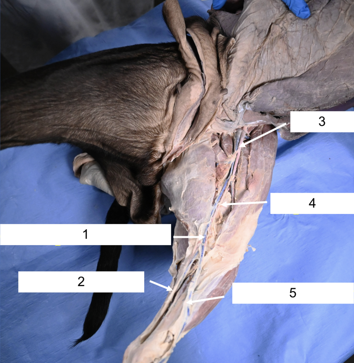 <p>What vein is 1? (be specific) </p>