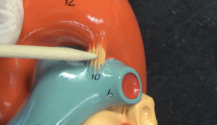 <ul><li><p>ductus arteriosis (used to be)</p></li></ul><p></p>